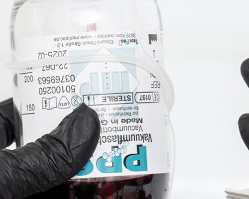 What is Ozone Therapy and What are its Benefits?